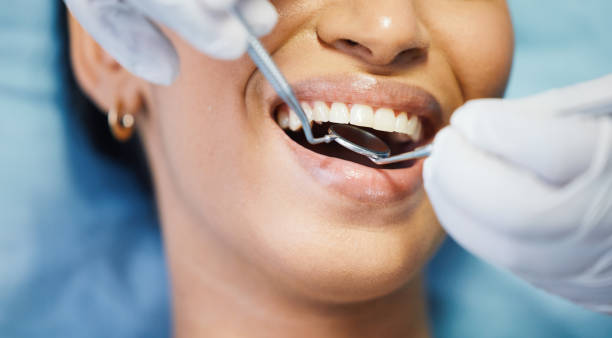 Best Knocked-Out Tooth Emergency  in Durand, MI